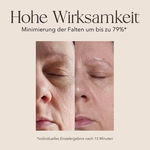 mellow NOIR Hyaluron Booster Serum – Vegan & Straffend | Gesicht & Augen | 90ml, Grösse: Assortimento di 96 pezzi, 3 image