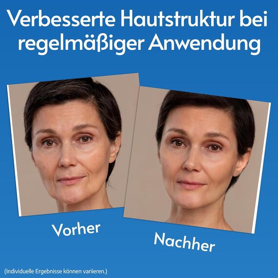 Hochdosiertes Hyaluron Serum mit Vitamin C & E, Anti-Aging & Feuchtigkeit, 60 ml, 5 image