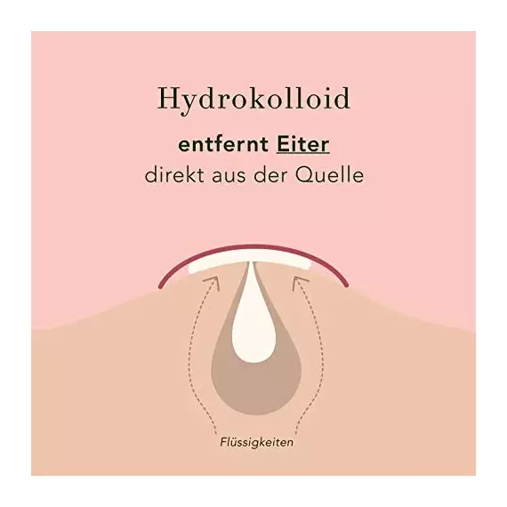Rael Hydrokolloid Akne Pimple Patch – Unsichtbar, Makelfleck, Hydrokolloid, Hautbehandlung, zwei Grössen (96 count), 3 image