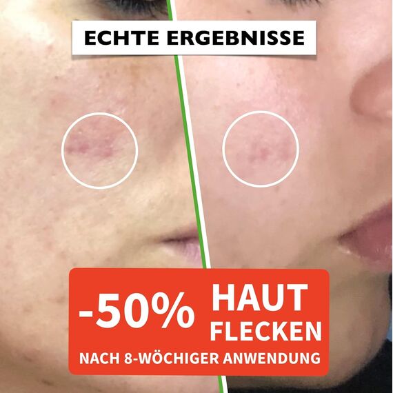 Bio Hyaluron Serum 60 ml – Mit Vitamin C & E | Anti-Falten & Anti-Aging | Vegan & Naturkosmetik, 2 image