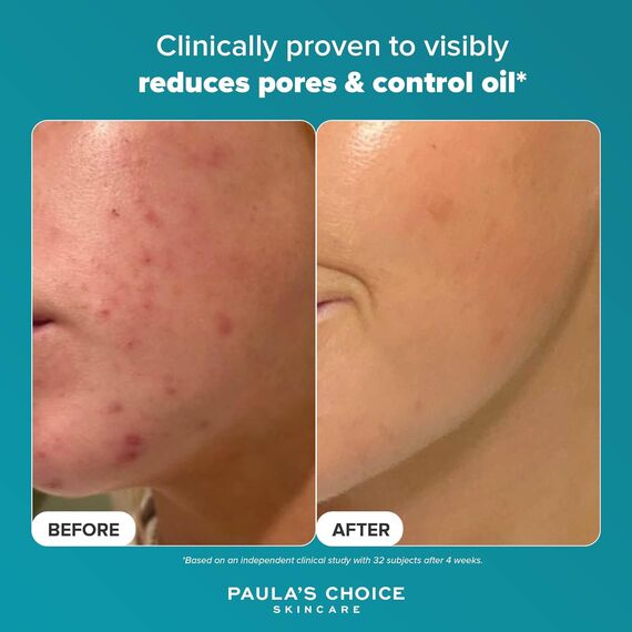 Paula's Choice 2% BHA Liquid Peeling – Salicylsäure gegen Mitesser, Poren & Unreine Haut - 118 ml, Grösse: 24 Unidad, 3 image