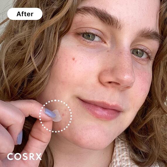 COSRX Master Patch 96 Stk (4er Pack) – Anti-Pickel Patches in 3 Grössen, Intensive Akne-Behandlung, Grösse: Assortimento di 96 pezzi, 2 image