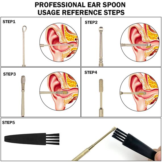 Hion Ohrenreiniger, Ohrenschmalz Entferner 6 in1 Medizinischer Ohrreiniger aus Edelstahl mit Aufbewahrungskiste Ear Cleaner, Geeignet für Kinder Jugendliche und Erwachsene(Gold)