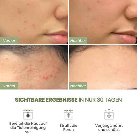PLANTIFIQUE Koreanische Gesichtsmaske mit Avocado, Fango & Superfoods 100g - Tonerde Maske Körper und Gesicht Anti Pickel Poren Mitesserentferner - Korean Clay Face & Body Mask