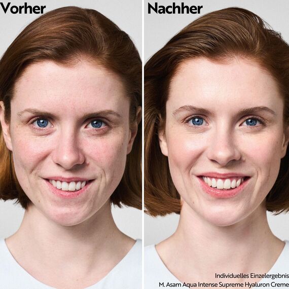 M. Asam AQUA INTENSE Supreme Hyaluron Cream (100 ml) – Parfümfreie Feuchtigkeitscreme mit Hyaluron, 120h Feuchtigkeitskomplex, Anti-Falten-Effekt, leichte Textur