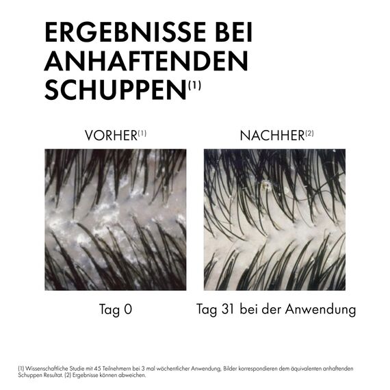VICHY Anti-Schuppen-Shampoo, Für normales bis fettiges Haar, Juckreiz-mildernd und hydratisierend, Mit Salicylsäure, Selendisulfid und Vitamin E, Dercos Advanced Action Anti-Schuppen, 390 ml