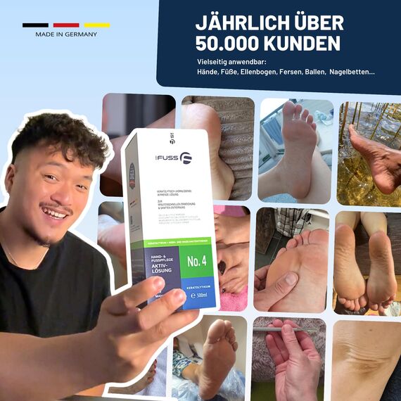 Mr. Fuss Callus Remover Lösung No. 4 500ml für Füße - Flüssiger Hornhaut- und Nagelhautentferner mit Sofortwirkung für sanfte Fuß- und Handpflege