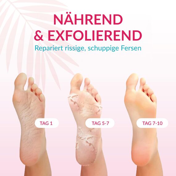 Summer Foot Premium Hornhaut-Entferner - Hornhaut Fußmaske für weiche Füße - Anti Hornhaut-Socken für effektive Fußpflege - dermatologisch getestet - Frauenmaske