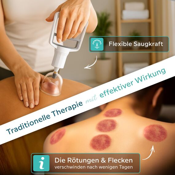 KURGLAS Schröpfgläser mit Vakuumpumpe [14 Stück] - Medizinische Schröpfen mit Therapiemagneten & Faszienschaber - Schröpfset mit e-Book - Schröpfglas aus Kunststoff - Gegen Verspannungen & Cellulite