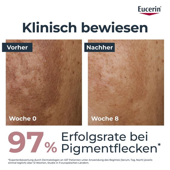Eucerin Anti-Pigment Nachtpflege 50 ml, reichhaltige Nachtcreme mit Thiamidol zur Reduzierung von Pigmentflecken, Gesichtspflege unterstützt die Hautregeneration über Nacht