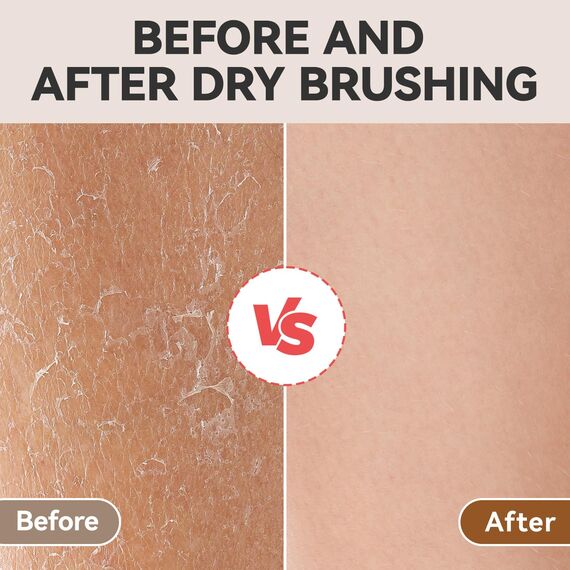 Ithyes Trockenbürste, Körperbürste, Peelingbürste, natürliche Borsten, Badebürste zum Entfernen abgestorbener Haut, Cellulite, verbessert Lymphfunktionen, Peeling