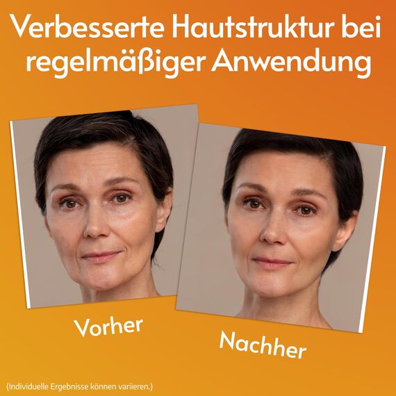 Vitamin C Serum Gesicht mit Hyaluron für Microneedling Hochdosiert + Hyaluronsäure + Vitamin E | Pickelmale & Pigmentflecken Entferner Gesicht | Brightening Face Serum | Dermaroller Serum | 60 ml