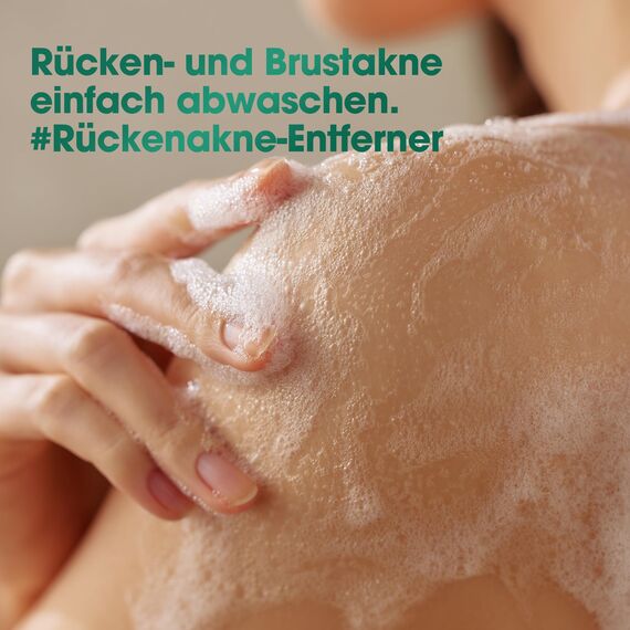 SOME BY MI AHA BHA PHA 30 Days Miracle Acne Clear Body Cleanser – 400ml – Exfolierendes Duschgel mit Teebaum & Salicylsäure – Klärt Poren & entfernt Unreinheiten – Koreanische Hautpflege