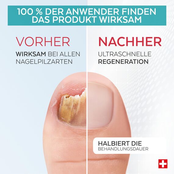 PODERM - BOOSTER GEGEN - Ergänzt die Behandlung von hartnäckigen - Halbiert die Behandlungszeit - Nicht einzeln anwenden - Swiss Made - PODERM