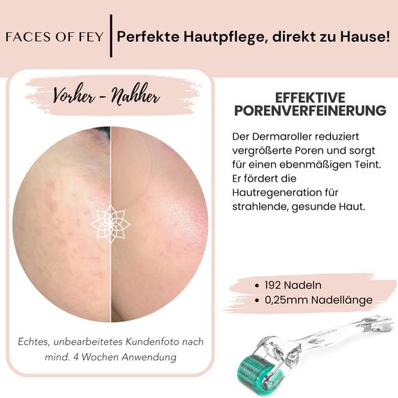 FACES OF FEY Microneedling Set gegen vergrößerte Poren – Dermaroller 0,25 mm mit ECHTEN 192 Nadeln - 10% Niacinamid Serum & Sanitizer für eine strahlende Haut