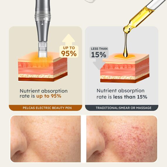PELCAS Dermapen mit 9 Geschwindigkeitsstufen Mikronadelgerät einstellbare Länge Elektrisch Microneedling Pen Schönheit Pen mit 12 Patronen Wiederaufladbar Kabellos Mikronadel Stift