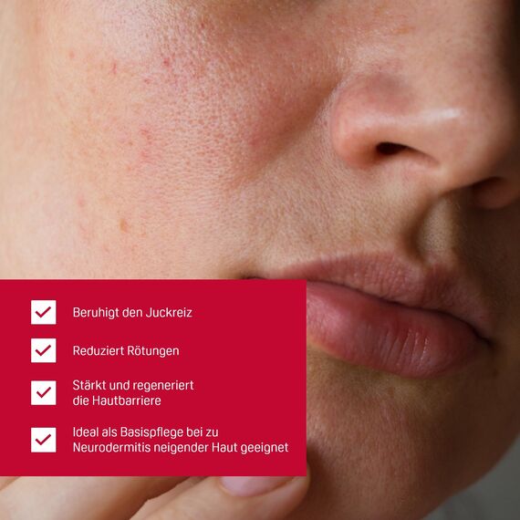 PHYSIOGEL Calming Relief A.I. Creme 50 ml - beruhigende Hautcreme für empfindliche Haut - regenerierende Körpercreme bei Juckreiz und Reizungen der Haut