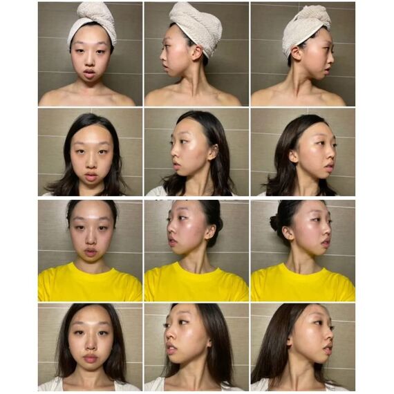 Gua Sha MassagegeräT, Jade Roller Set, Natü Rliche Jaderolle, Gesichts FüR Anti-Aging-Falten, Schlankheit Und Straffung Gesicht, Gesichtsroller Gesichtsmassage (Jade Roller Set-1)