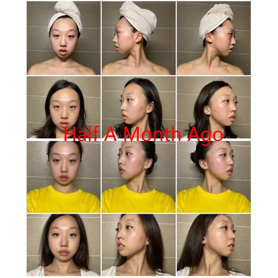 Gua Sha MassagegeräT, Jade Roller Set, Natü Rliche Jaderolle, Gesichts FüR Anti-Aging-Falten, Schlankheit Und Straffung Gesicht, Gesichtsroller Gesichtsmassage (Jade Roller Set-1)