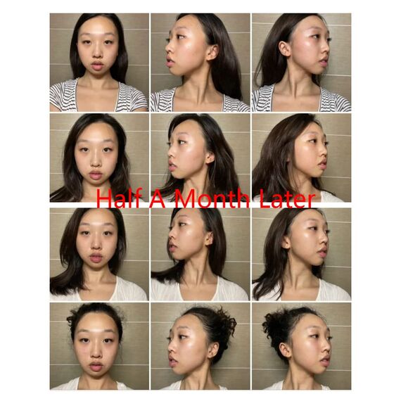 Gua Sha MassagegeräT, Jade Roller Set, Natü Rliche Jaderolle, Gesichts FüR Anti-Aging-Falten, Schlankheit Und Straffung Gesicht, Gesichtsroller Gesichtsmassage (Jade Roller Set-1)