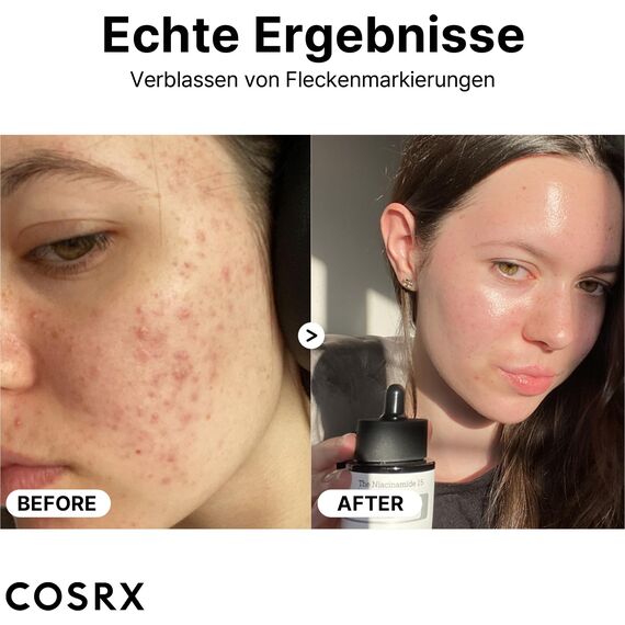 COSRX Niacinamide 15% Gesichtsserum, Verkleinert vergrößerte Poren, Beruhigt Rötungen, Korrigierende Behandlung von Verfärbungen, 20 ml, Nicht an Tieren getestet, Korean Skincare