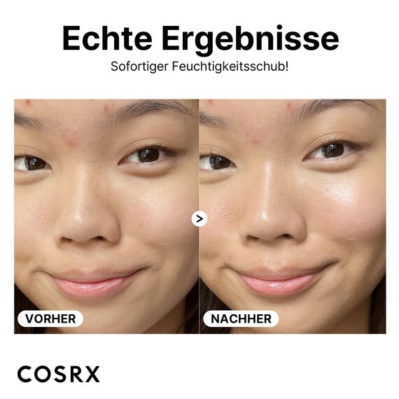 COSRX Pure Hyaluronic Acid 3% Serum, Reines Hyaluron Serum hochdosiert - mit reiner Hyaluronsäure & Ceramide, Anti Aging & Anti Falten Feuchtigkeitspflege, für alle Hauttypen, Korean Skincare
