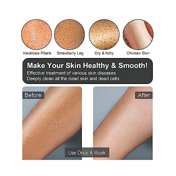 Yiclick Koreanische Peeling-Handschuhe, Peelinghandschuh für Bad - Peeling Handschuh Körperpeeling - abgestorbene Haut Entferner für Damen und Herren - exfoliating glove, peeling, body scrub (Black)