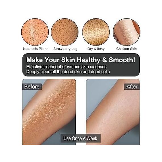 Yiclick 4 Stück Peelinghandschuh Peeling Handschuhe - Exfoliating gloves, Körperpeeling Peeling Körper, Body Scrub, Duschschwamm, Peeling Luffa Schwamm Bürste Waschlappen Rückenbürste