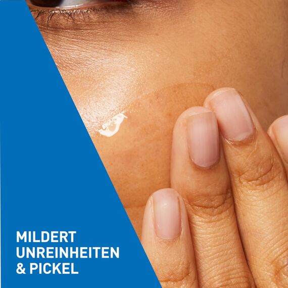 CeraVe Anti-Unreinheiten Gel für das Gesicht, Peelingeffekt gegen unreine und zu Akne neigender Haut, Mit Salicylsäure, Glykolsäure und 3 essenziellen Ceramiden, 40 ml