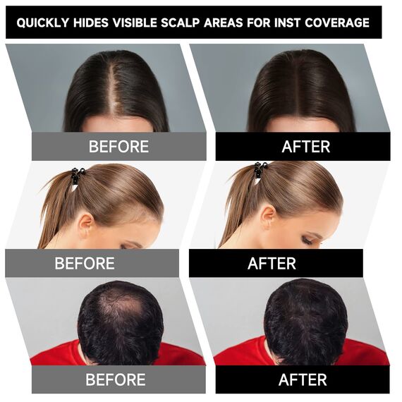 MIFELOY Haaransatz Puder mit Spiegel Schwamm, Dunkel Grau Unsichtbares Ansatzpuder, Soforteffekt Concealer zur Haarverdichtung für Frauen Männer, Wasserfestes Haar Make-up zum Ansatz kaschieren