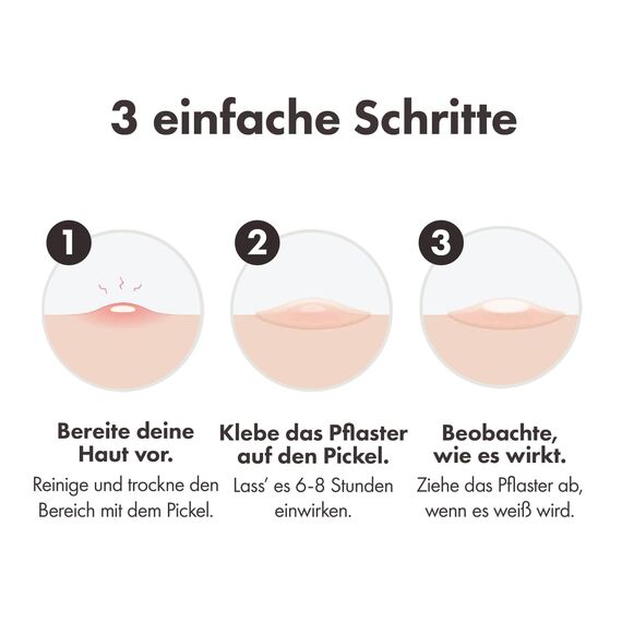 Mighty Patch Original Pickel-Patches von Hero Cosmetics, unsichtbare Hydrokolloid-Pflaster zur Aknebehandlung, 36 Stück