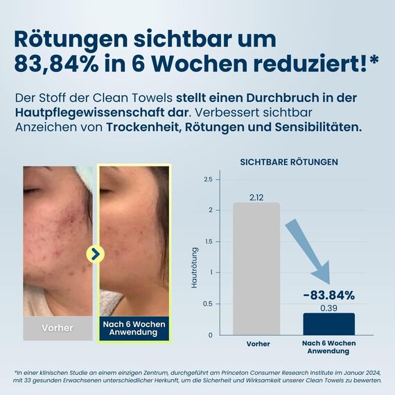 Clean Skin Club Clean Towels XL Supreme, 100% USDA biobasiertes, von Dermatologen zugelassenes Gesichtshandtuch, sanftes Peeling, Einweg-Gesichtswaschlappen, Make-up-Entferner-Trockentücher, 50 Stück