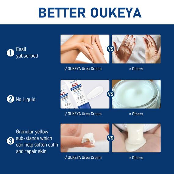 OUKEYA Urea-Creme 40 Prozent für Fuß und Hände, Urea Cream Fuß, Fußcreme, Harnstoffcreme für Trockene, Rissige Füße, Anti Hornhaut, für Hände, Fersen, Ellenbogen, Ideal für Unterwegs, 85g, 2er Pack