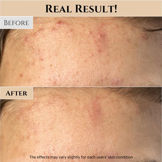 Beauty of Joseon Reis- und Honig-Glow-Maske zur Pflege der Poren und Sebumkontrolle für trockene, empfindliche Haut, koreanische Hautpflege für Männer und Frauen, 150 ml