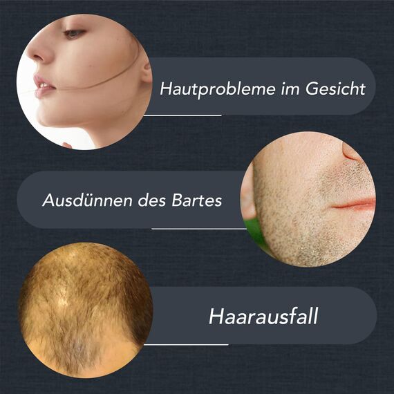 Dr.roller Bartroller 0,5 mm, Derma Roller Haare, Bartroller Bartwuchs, Microneedling Roller, Derma Roller mit 540 Mikro Titan Nadeln für Gesicht, Kopfhaut, Haarverlust, Narben