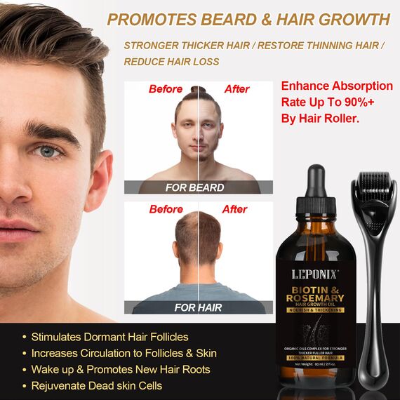 Dermaroller Haare Rossmarin Öl Haare Wachstum Set 0.25mm Microneedling Roller mit Haarserum für Haarwachstum Haarwuchsmittel Haarwachstum Beschleunigen Anti-Haarausfall