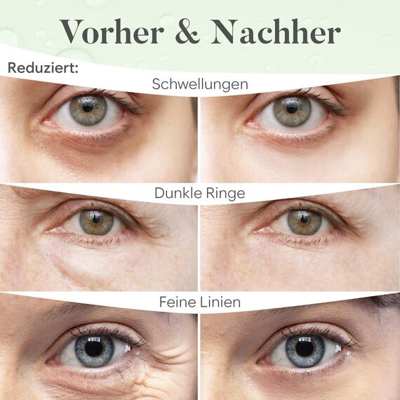 BLOOMORA Grüner Tee Augenpads (30 Paare) - Eye Pads mit Niacinamid & Augenpads Hyaluron - Augenpadz Gegen Augenringe - Augenringe Entfernen - Eye Patches