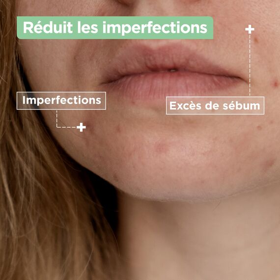 Mixa Anti-Unreinheiten Gesichtspflege- und Reinigungsduo: Salicysäure & Niancinamid Serum 30ml gegen Unreine Haut + Cleanser für zu unreinheiten neidgende Haut 150ml