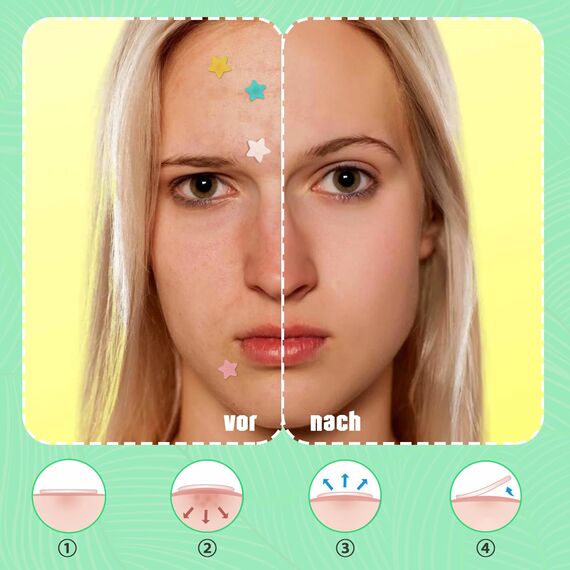 Pimple Patches Hydrokolloid Unsichtbare Pickel Patch mit Teebaumöl Tag und Nacht Verwenden Pimple Patch Akne Patches Wasserdichte Atmungsaktive Acne Patch Pflaster (240 Stück, Star)