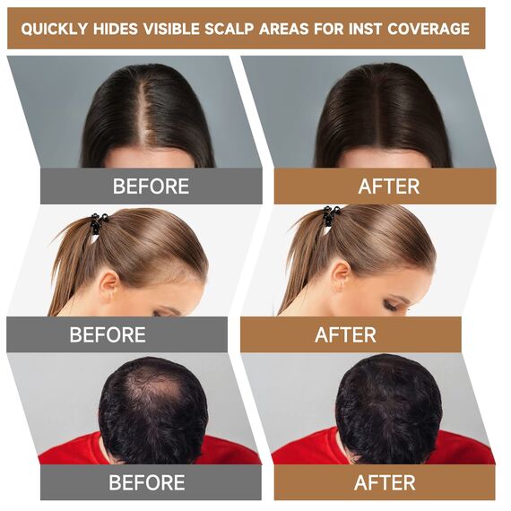 MIFELOY Unsichtbares Ansatzpuder, Männer Wasserfestes Haaransatz Puder, Frauen Soforteffekt Concealer zur Haarverdichtung, Haar Abdecken zum Ansatz kaschieren Dünne Stellen Kahle Graue, Blond