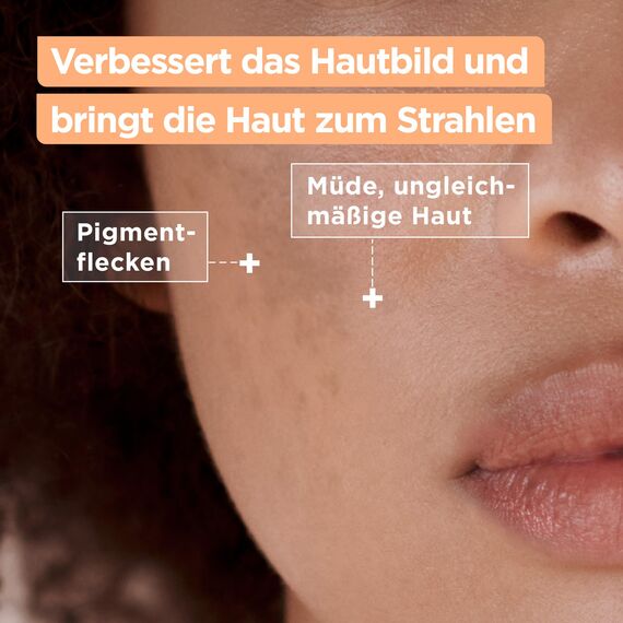 Mixa Anti-Pigmentflecken Creme, Für ungleichmäßige, fahle und sensible Haut mit Vitamin C und Niacinamid, Geeignet für Gesicht & Hals, LSF 20, Hypoallergen, 50 ml