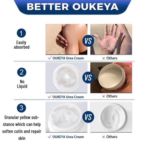 OUKEYA Urea-Creme 40 Prozent für Fuß und Hände, Urea Cream Fuß, Fußcreme, Harnstoffcreme für Trockene, Rissige Füße, Anti Hornhaut, Lotion für Fersen, Ellenbogen, Maximaler Stärke, 350g