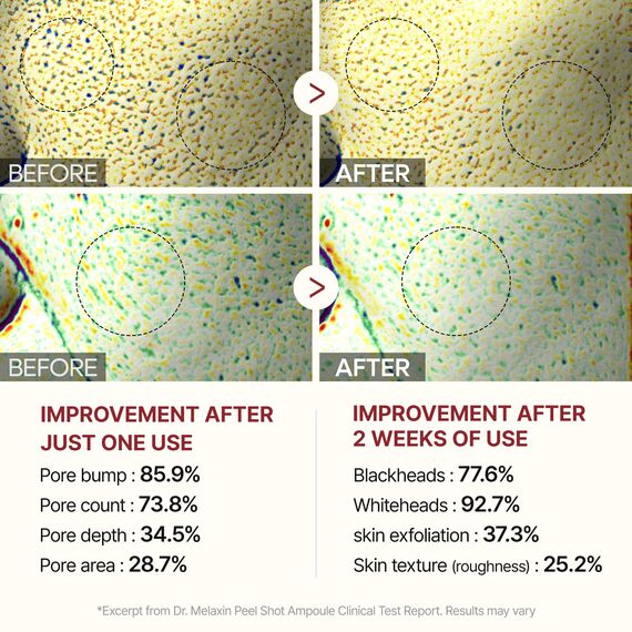 Dr.Melaxin Peel Shot Glow Black Rice Peeling Ampulle, weiches Peeling, Gesicht und Körper, Peeling für abgestorbene Hautzellen, Mitesserentferner für alle Hauttypen, koreanische Hautpflege, 80 ml