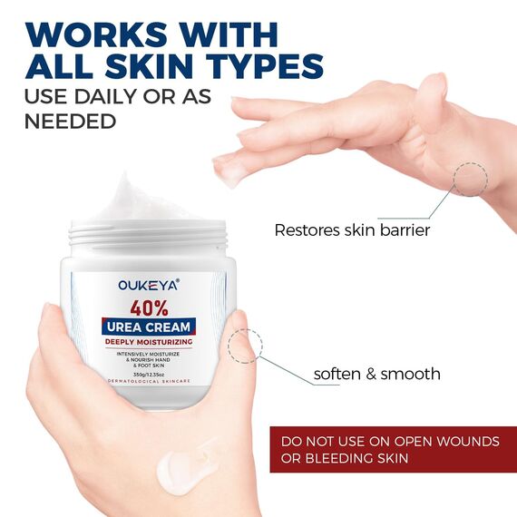 OUKEYA Urea-Creme 40 Prozent für Fuß und Hände, Urea Cream Fuß, Fußcreme, Harnstoffcreme für Trockene, Rissige Füße, Anti Hornhaut, für Fersen, Ellenbogen, Maximaler Stärke, 350g, 4er Pack