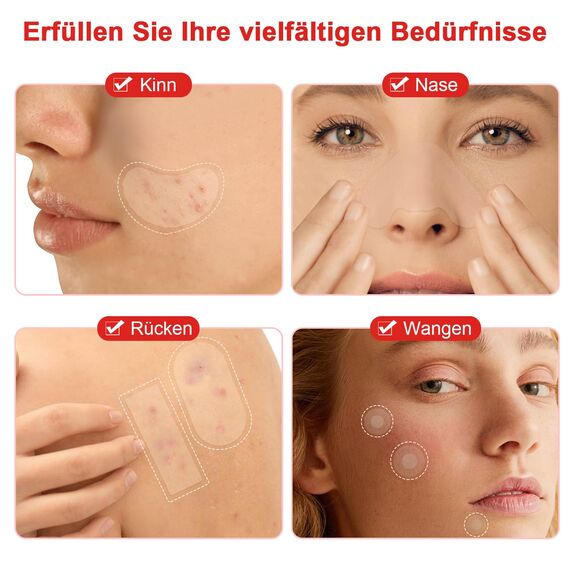 Große Pickel Patches,Pickel Pflaster,XL Hydrokolloid Pimple Patches,Anti Akne-Patch für Gesicht und Körper mit Teebaumöl, Salicylsäure Schnelle Heilung für Große Zit Breakouts an Kinn, Wangen, Rücken