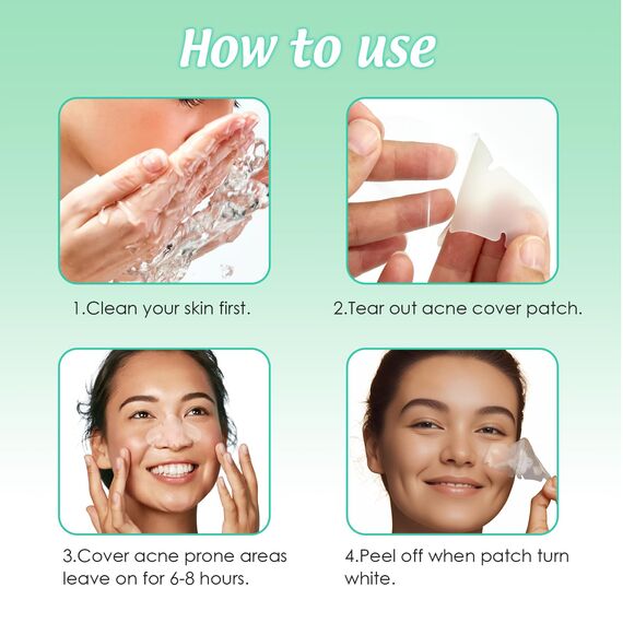 Pimple Patches Hydrokolloid Unsichtbare Pickel Patch mit Teebaumöl Tag und Nacht Verwenden Pimple Patch Akne Patches Wasserdichte Atmungsaktive Acne Patch Pflaster (20 Stück, Nase)