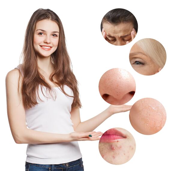 30 Stück Microneedling Nadeln Schraubenmund 36 Pin Ersatz Nadeln Patrone Microneedling Gerät Ersatz Nadeln Nano Mikronadel Derma Pen Mikronadelstifte passend für Schraubmundtypen