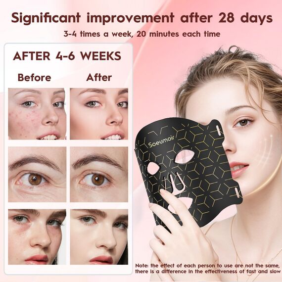 Soeumoir LED Gesichtsmaske mit Rotlichttherapie – 7 Farben LED Lichtmaske gegen Akne, Falten & Hautverjüngung – Pflegegerät für alle Hauttypen – Professionelle Hautpflege für Zuhause & Reise