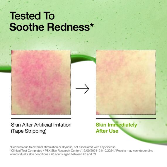 Anua Azelaic Acid 10 Hyaluron Redness Soothing Serum, Facial Serum for Sensitive skin, Hyaluronic Acid, Niacinamide, Spot Care, Natural Color, Vegan, Korean Skincare (30ml/ 1.01 fl oz.)