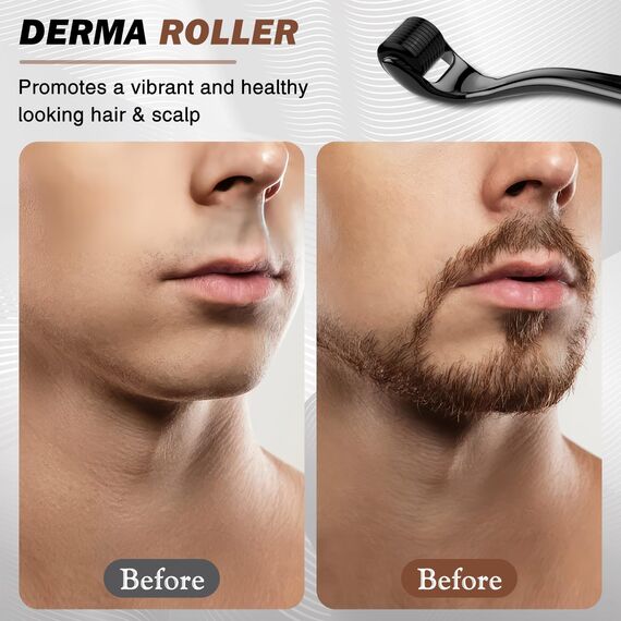 Bartroller 0,5 mm – Derma-roller mit 540 Titan-Nadeln für Bartwuchs & Haarwachstum, professioneller Microneedling Roller für Gesicht, Kopfhaut & Körper – Männer & Frauen, Anti-Aging, Hautpflege